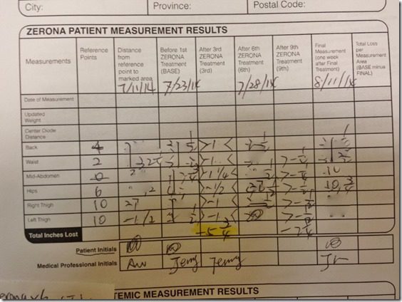 zerona results and review (800x600)