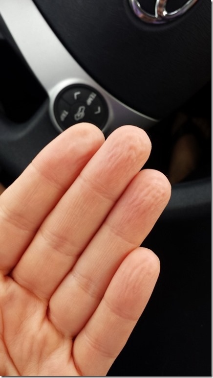 wrinkly fingers after yoga (450x800)