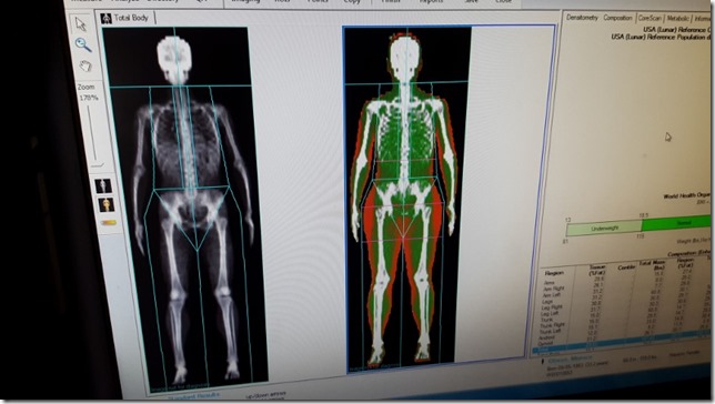 body spec dxa fat measurement scan 1 (800x450)