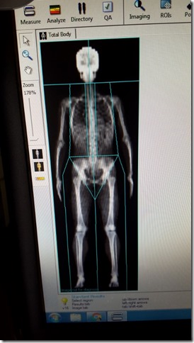 body spec dxa fat measurement scan (450x800)