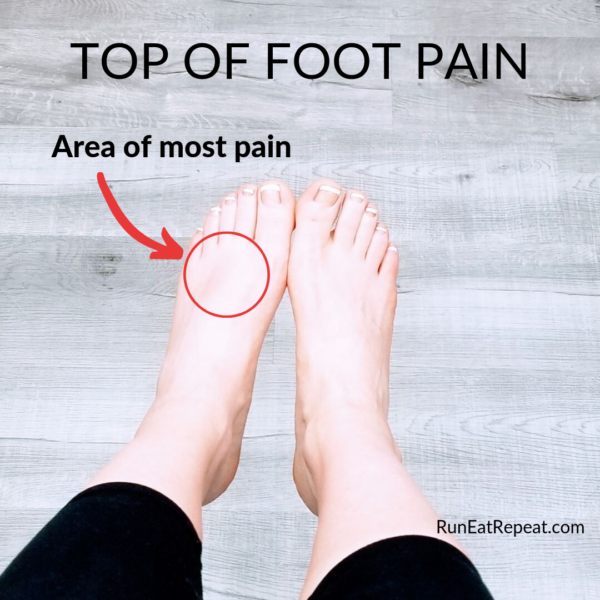 top of foot pain for runners
