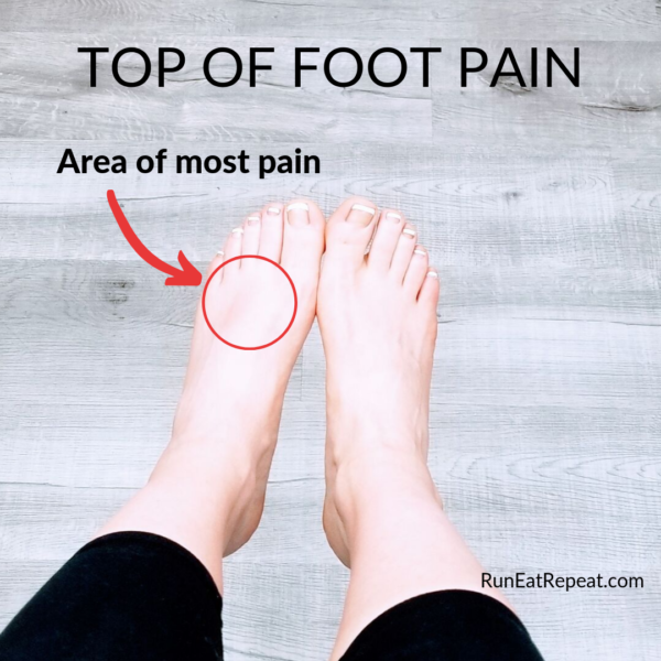 Pain On Top Of Foot After Running Top Sellers | emergencydentistry.com